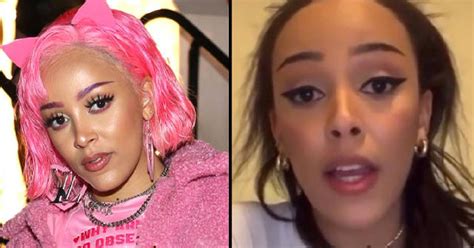 did doja cat get implants|what happened to doja cat.